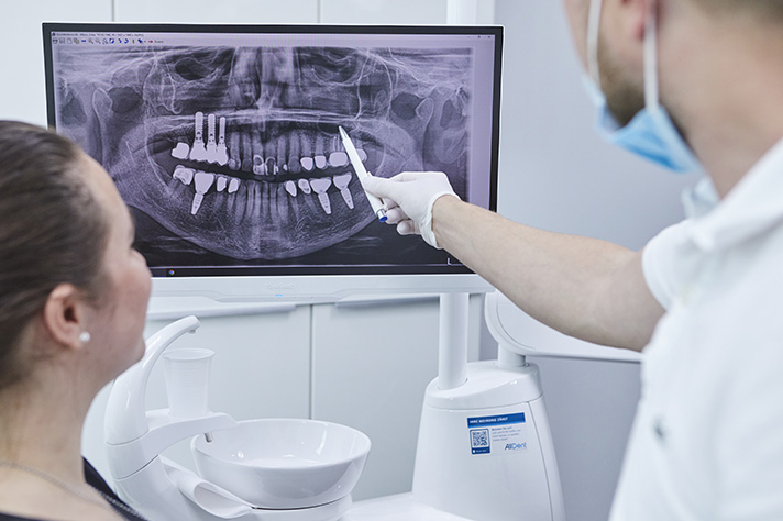 Arzt erklärt Patientin im AllDent Implantatzentrum Wiesbaden ein Röntgenbild ihres Kiefers